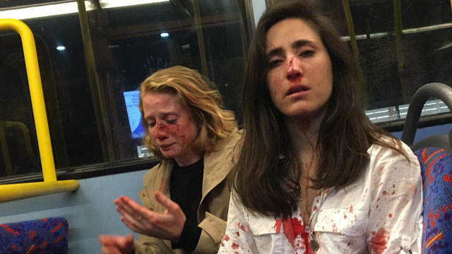 Melania Ramirez and Christine Hannigan shared this photo on social media after being attacked on a bus in May 2019