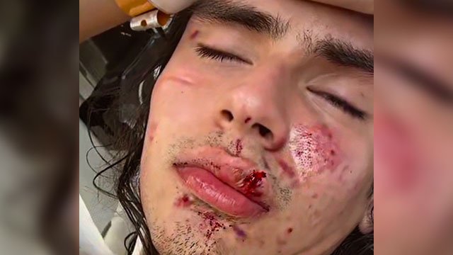 Sebastian Thomas Robles Lascarro was beaten by a mob outside a DC McDonalds