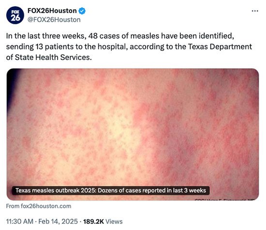 Measles outbreak continues to spread in Texas among unvaccinated